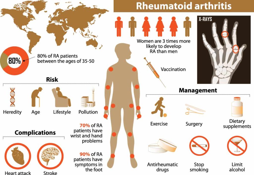 cbd-for-arthritis-01-infograph