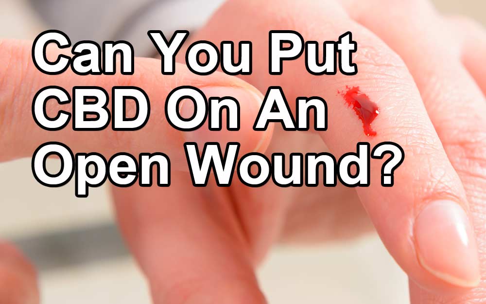 Can You Put CBD On An Open Wound?